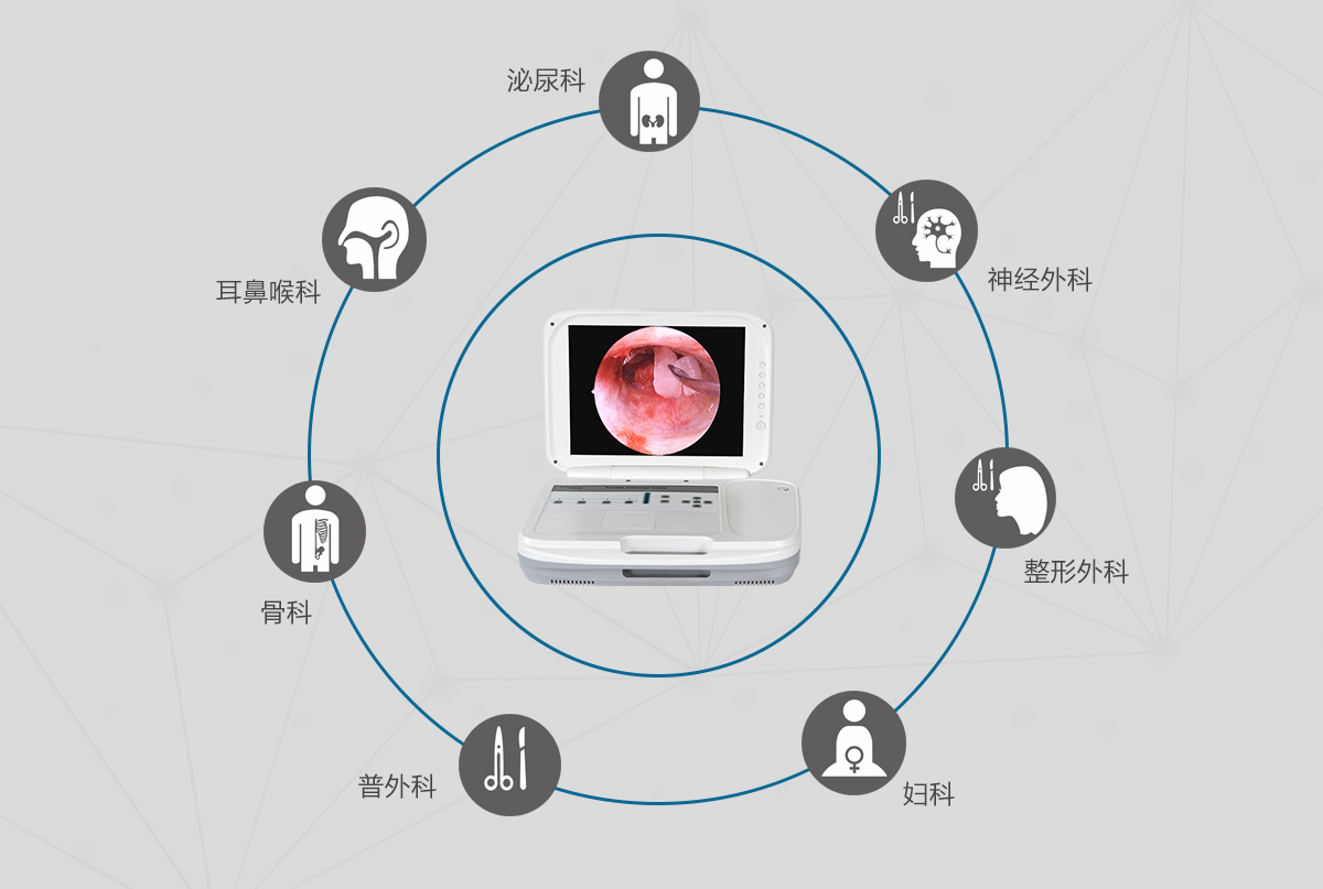 內(nèi)窺鏡攝像機的應(yīng)用領(lǐng)域有哪些？