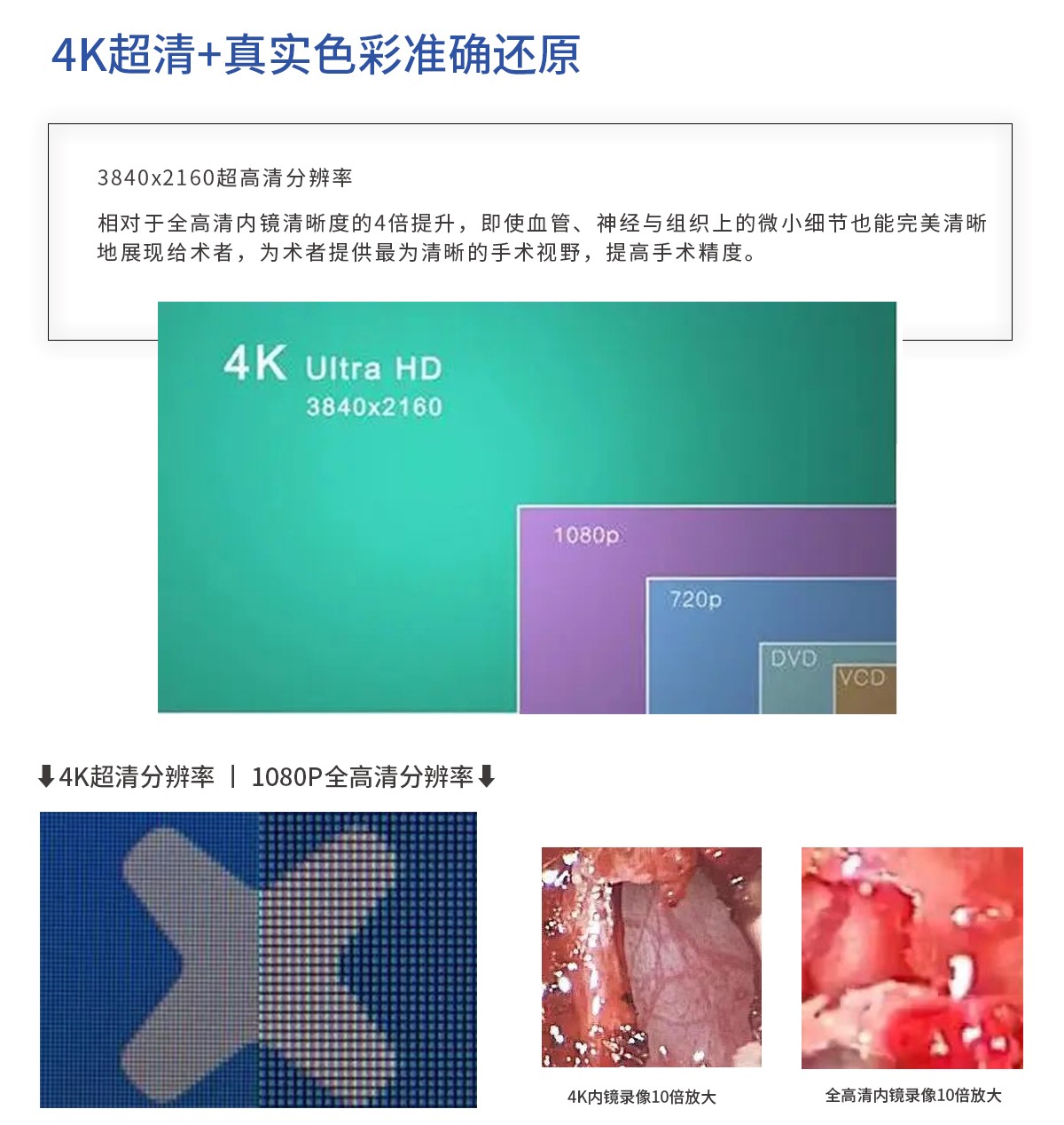 【4K醫(yī)用內(nèi)窺鏡攝像系統(tǒng)】您的第一臺“4K”找到了嗎？