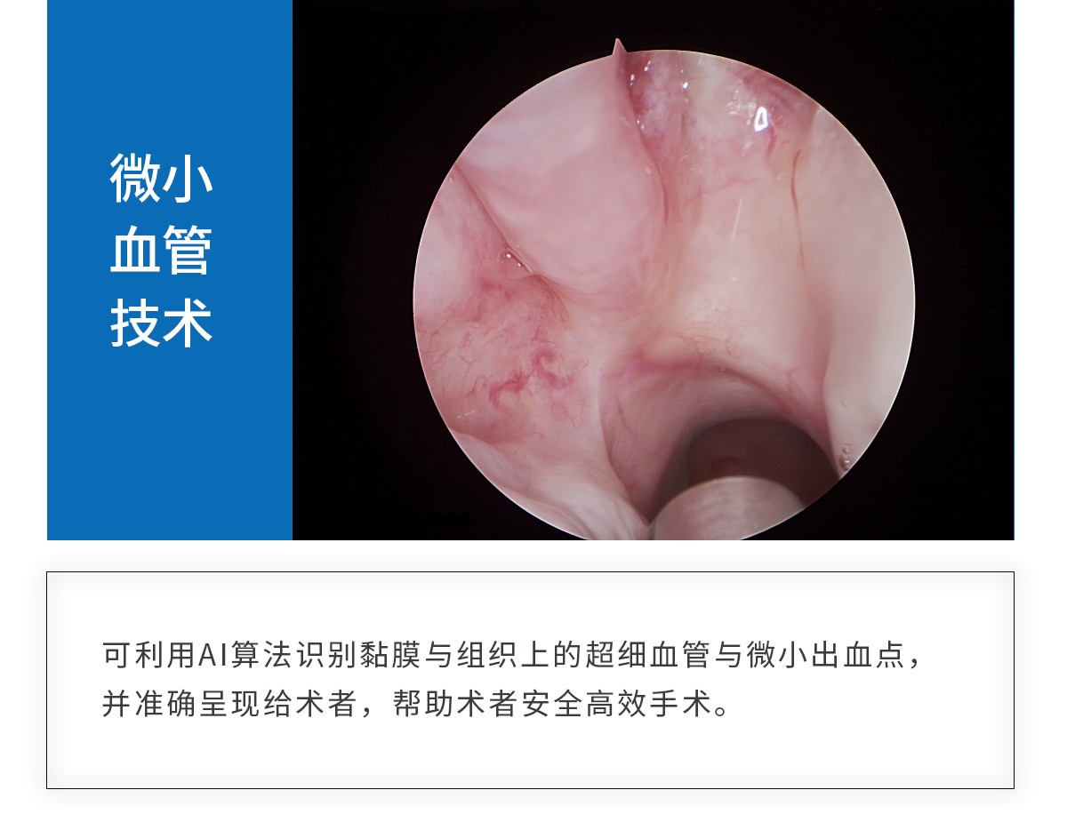 【4K醫(yī)用內(nèi)窺鏡攝像系統(tǒng)】您的第一臺“4K”找到了嗎？