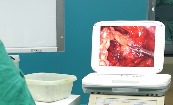 【腹腔鏡篇】腹腔鏡疝氣手術(shù)，您知道嗎？