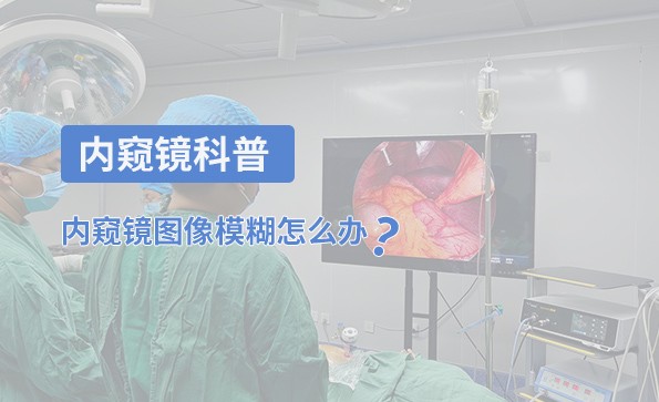 內(nèi)窺鏡科普：內(nèi)窺鏡圖像模糊怎么辦？